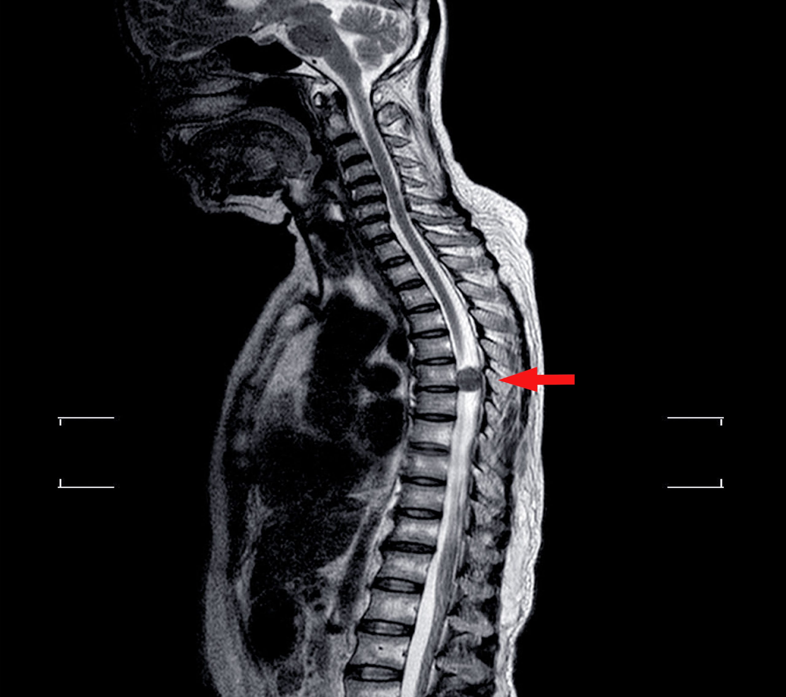 MRI Imaging Services in Ontario
