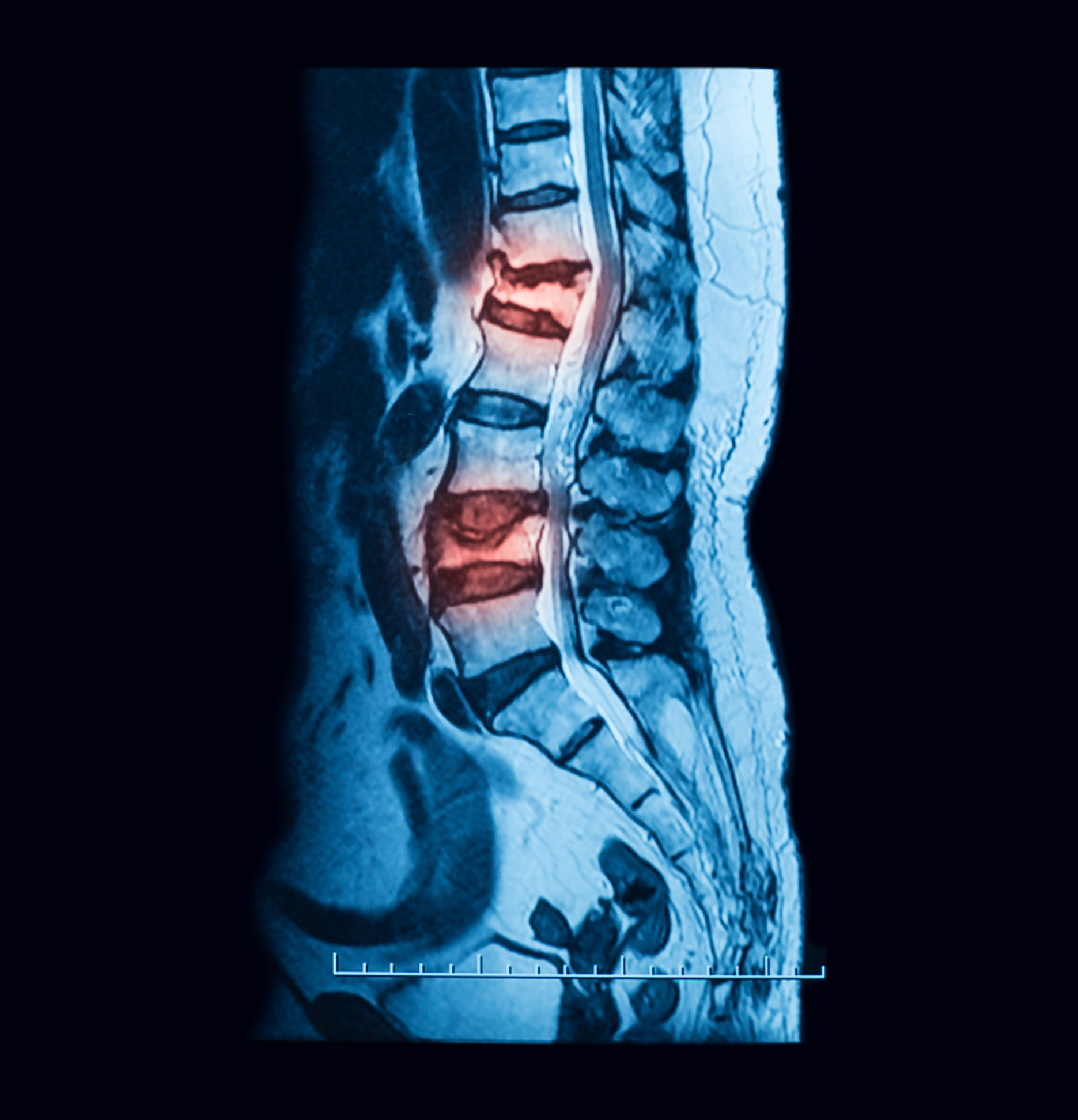 Magnetic Resonance Imaging Services
